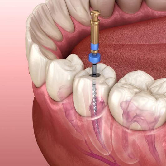 Endodontia
